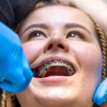 Orthodontie moderne