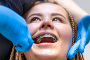 Orthodontie moderne