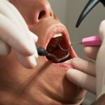 Chirurgie orale : interventions, préparation et suivi post-opératoire