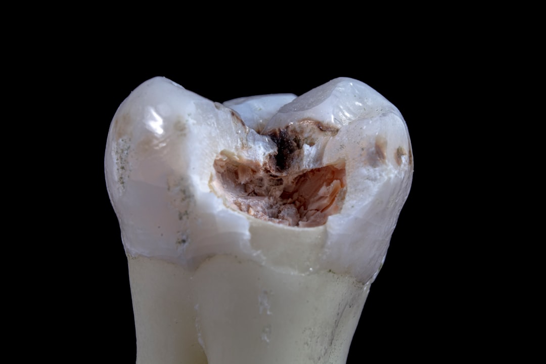 caries et risques cardiovasculaires
