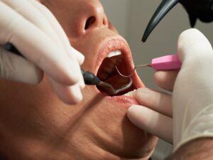 Chirurgie orale : interventions, préparation et suivi post-opératoire