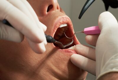 Chirurgie orale : interventions, préparation et suivi post-opératoire